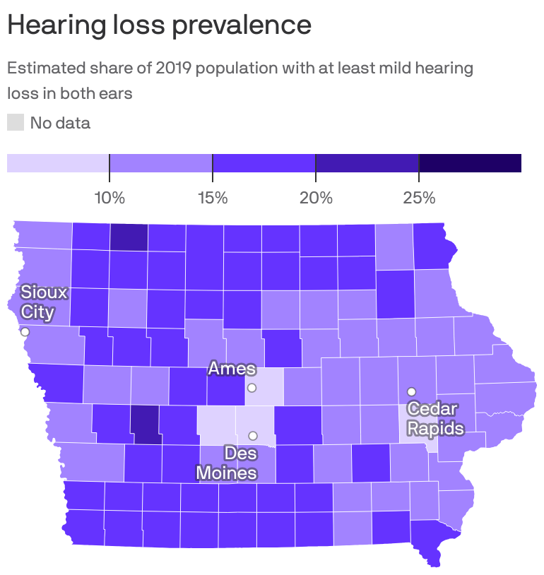 Saving residual hearing  Iowa Now - The University of Iowa