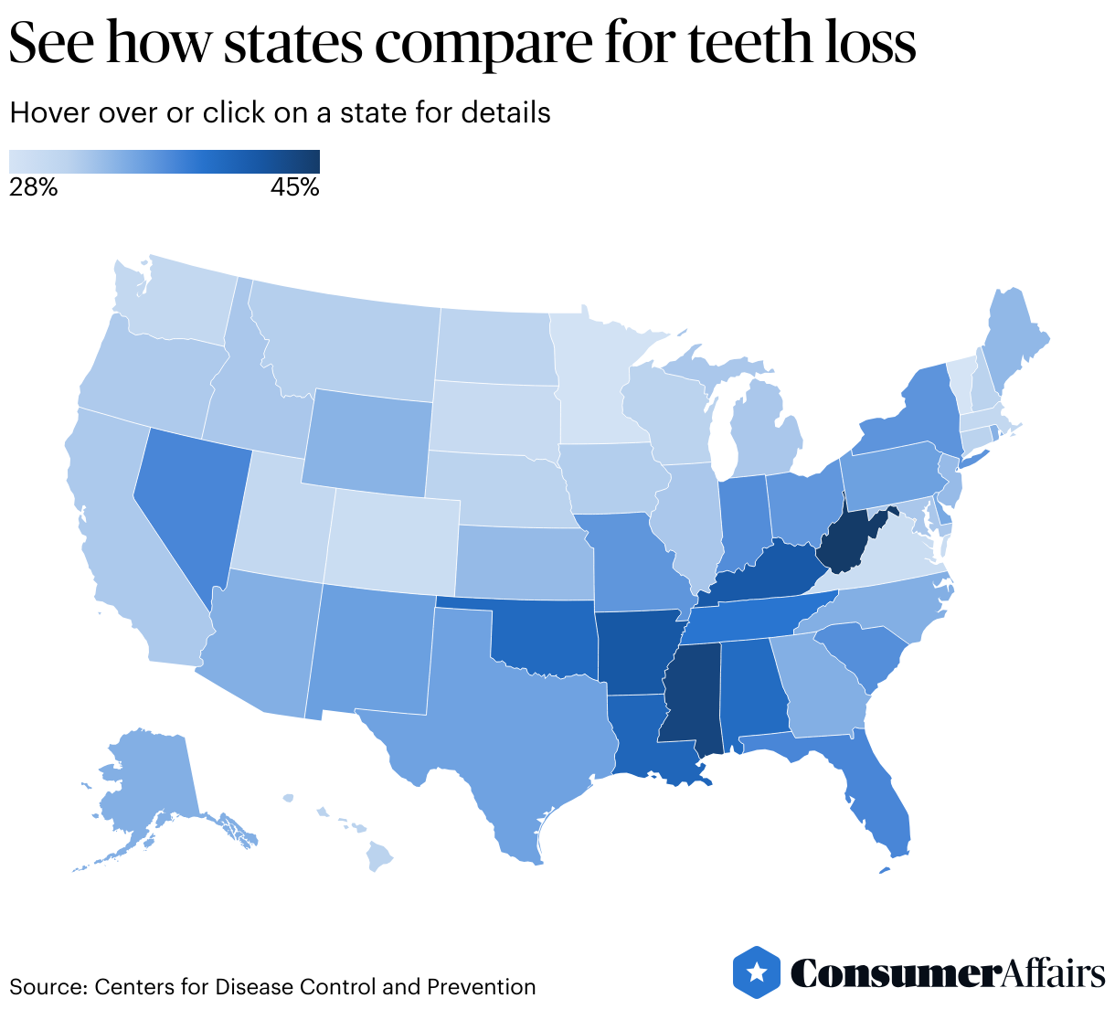 Consumer News: Losing teeth happens more in these U.S. states