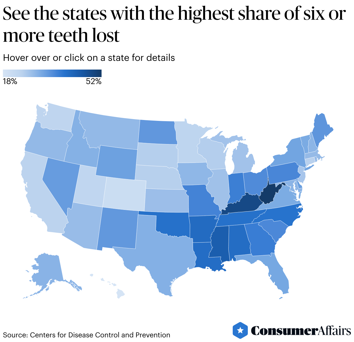 Consumer News: Losing teeth happens more in these U.S. states